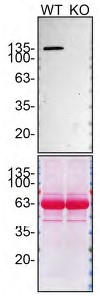 Western blot - Anti-SHIP-1 antibody [EP378Y] - BSA and Azide free (ab190551), expandable thumbnail