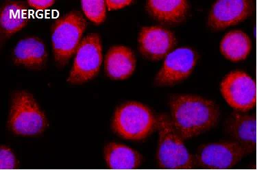 Immunocytochemistry/ Immunofluorescence - Anti-SHIP-1 (phospho Y1022) antibody [JJ082-03] (AB326640)