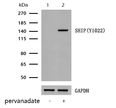 Western blot - Anti-SHIP-1 (phospho Y1022) antibody [JJ082-03] (AB326640)