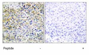 Immunohistochemistry (Formalin/PFA-fixed paraffin-embedded sections) - Anti-SHK antibody (AB69920)
