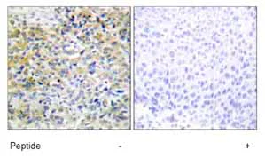 Immunohistochemistry (Formalin/PFA-fixed paraffin-embedded sections) - Anti-SHK antibody (AB69920)