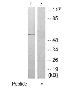 Western blot - Anti-SHK antibody (AB69920)