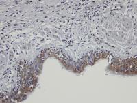 Immunohistochemistry (Formalin/PFA-fixed paraffin-embedded sections) - Anti-SHKBP1 antibody (AB98148)