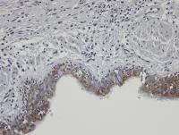 Immunohistochemistry (Formalin/PFA-fixed paraffin-embedded sections) - Anti-SHKBP1 antibody (AB98148)