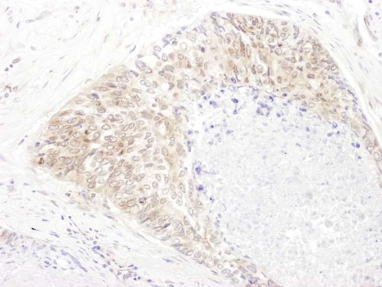 Immunohistochemistry (Formalin/PFA-fixed paraffin-embedded sections) - Anti-SHMT1 antibody (AB186130)