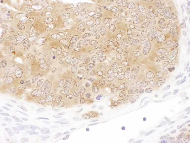 Immunohistochemistry (Formalin/PFA-fixed paraffin-embedded sections) - Anti-SHMT1 antibody (AB186130)