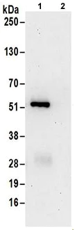 Immunoprecipitation - Anti-SHMT1 antibody (AB186130)