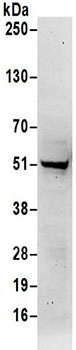 Western blot - Anti-SHMT1 antibody (AB186130)