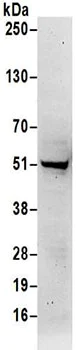Western blot - Anti-SHMT1 antibody (AB186130)