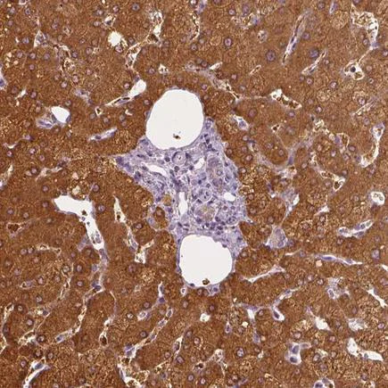 Immunohistochemistry (Formalin/PFA-fixed paraffin-embedded sections) - Anti-SHMT1 antibody - N-terminal (AB224445)