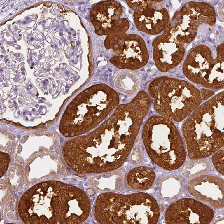 Immunohistochemistry (Formalin/PFA-fixed paraffin-embedded sections) - Anti-SHMT1 antibody - N-terminal (AB224445)