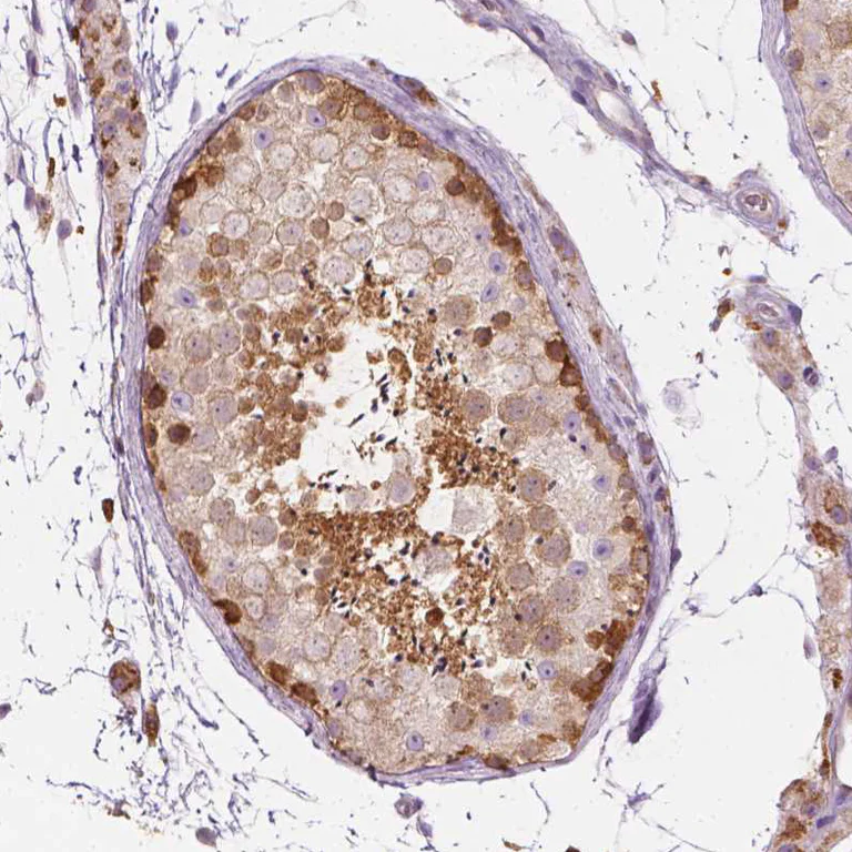 Immunohistochemistry (Formalin/PFA-fixed paraffin-embedded sections) - Anti-SHMT1 antibody - N-terminal (AB224445)