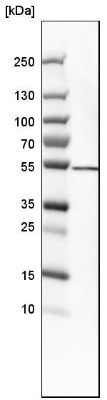 Western blot - Anti-SHMT1 antibody - N-terminal (AB224445)