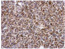 Immunohistochemistry (Formalin/PFA-fixed paraffin-embedded sections) - Anti-SHMT2/SHMT antibody (AB155230)