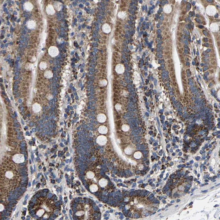 Immunohistochemistry (Formalin/PFA-fixed paraffin-embedded sections) - Anti-SHMT2/SHMT antibody (AB224427)