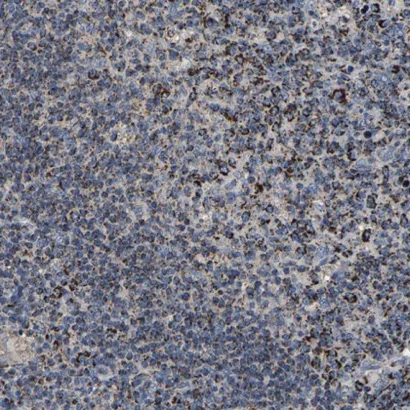 Immunohistochemistry (Formalin/PFA-fixed paraffin-embedded sections) - Anti-SHMT2/SHMT antibody (AB224427)