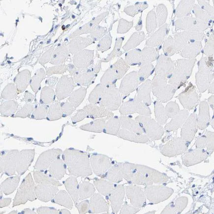 Immunohistochemistry (Formalin/PFA-fixed paraffin-embedded sections) - Anti-SHMT2/SHMT antibody (AB224428)