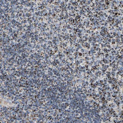 Immunohistochemistry (Formalin/PFA-fixed paraffin-embedded sections) - Anti-SHMT2/SHMT antibody (AB224428)