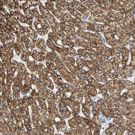 Immunohistochemistry (Formalin/PFA-fixed paraffin-embedded sections) - Anti-SHMT2/SHMT antibody (AB224428)
