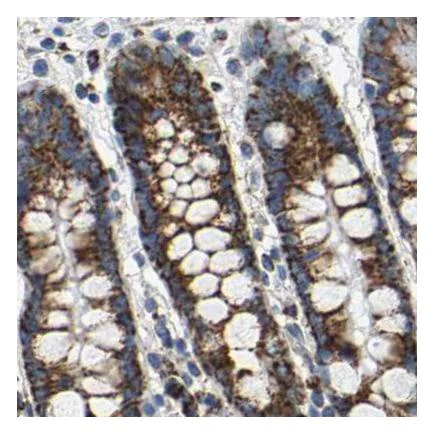 Immunohistochemistry (Formalin/PFA-fixed paraffin-embedded sections) - Anti-SHMT2/SHMT antibody (AB224428)