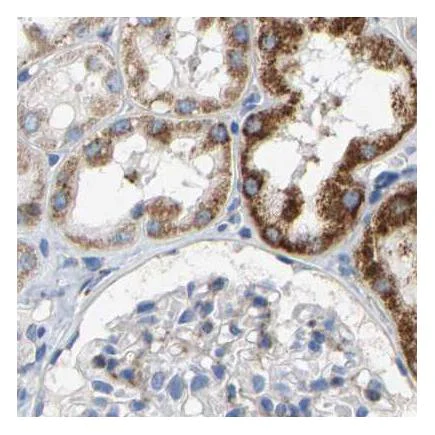 Immunohistochemistry (Formalin/PFA-fixed paraffin-embedded sections) - Anti-SHMT2/SHMT antibody (AB224428)