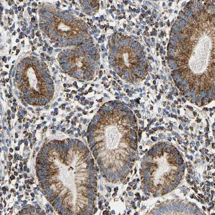 Immunohistochemistry (Formalin/PFA-fixed paraffin-embedded sections) - Anti-SHMT2/SHMT antibody (AB224428)