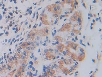Immunohistochemistry (Formalin/PFA-fixed paraffin-embedded sections) - Anti-SHMT2/SHMT antibody (AB233430)