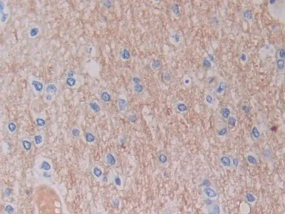 Immunohistochemistry (Formalin/PFA-fixed paraffin-embedded sections) - Anti-SHMT2/SHMT antibody (AB233430)