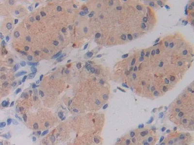 Immunohistochemistry (Formalin/PFA-fixed paraffin-embedded sections) - Anti-SHMT2/SHMT antibody (AB233430)