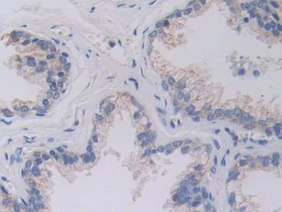 Immunohistochemistry (Formalin/PFA-fixed paraffin-embedded sections) - Anti-SHMT2/SHMT antibody (AB233430)