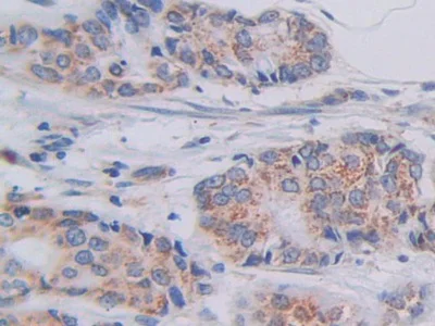 Immunohistochemistry (Formalin/PFA-fixed paraffin-embedded sections) - Anti-SHMT2/SHMT antibody (AB233430)