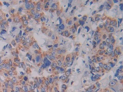 Immunohistochemistry (Formalin/PFA-fixed paraffin-embedded sections) - Anti-SHMT2/SHMT antibody (AB233430)