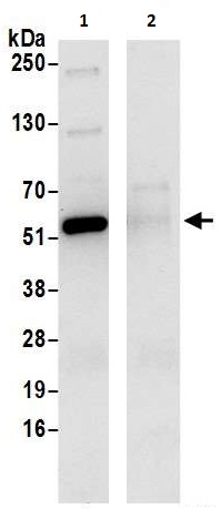 Immunoprecipitation - Anti-SHMT2/SHMT antibody (AB240606)
