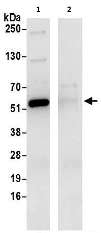 Immunoprecipitation - Anti-SHMT2/SHMT antibody (AB240606)