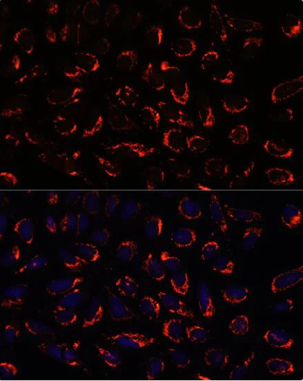 Immunocytochemistry/ Immunofluorescence - Anti-SHMT2/SHMT antibody - C-terminal (AB180786)