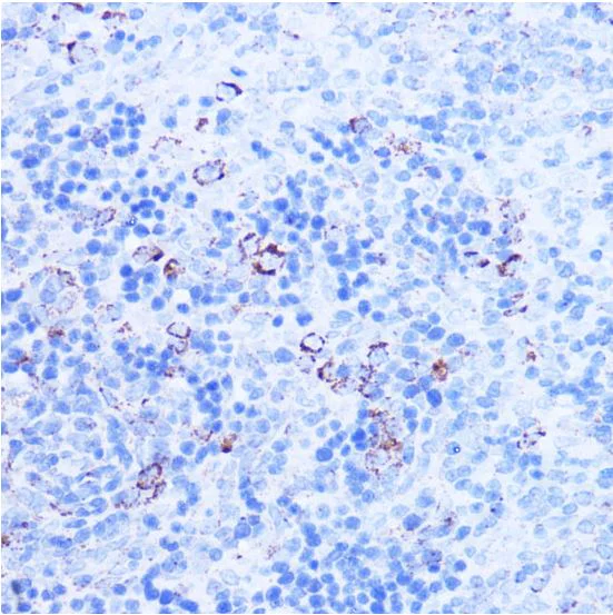 Immunohistochemistry (Formalin/PFA-fixed paraffin-embedded sections) - Anti-SHMT2/SHMT antibody - C-terminal (AB180786)