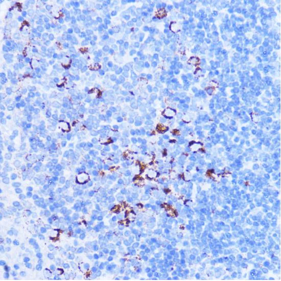 Immunohistochemistry (Formalin/PFA-fixed paraffin-embedded sections) - Anti-SHMT2/SHMT antibody - C-terminal (AB180786)