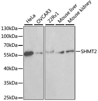 Western blot - Anti-SHMT2/SHMT antibody - C-terminal (AB180786)