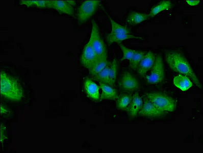Immunocytochemistry/ Immunofluorescence - Anti-Shoc2 / Sur8 antibody (AB229805)