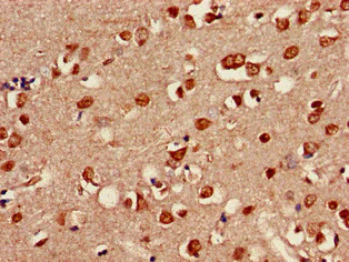 Immunohistochemistry (Formalin/PFA-fixed paraffin-embedded sections) - Anti-Shoc2 / Sur8 antibody (AB229805)