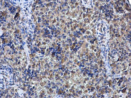 Immunohistochemistry (Formalin/PFA-fixed paraffin-embedded sections) - Anti-Shoc2 / Sur8 antibody - C-terminal (AB229315)