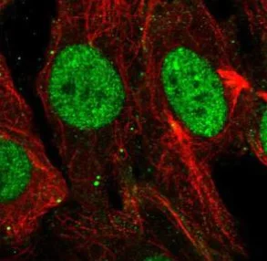 Immunocytochemistry/ Immunofluorescence - Anti-SHOX antibody (AB220886)