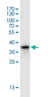 Western blot - Anti-SHOX2 antibody [1D1] (AB55740)