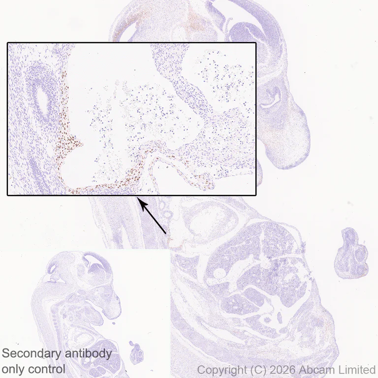 Immunohistochemistry (Formalin/PFA-fixed paraffin-embedded sections) - Anti-SHOX2 antibody [EPR30169-39] (AB326071)