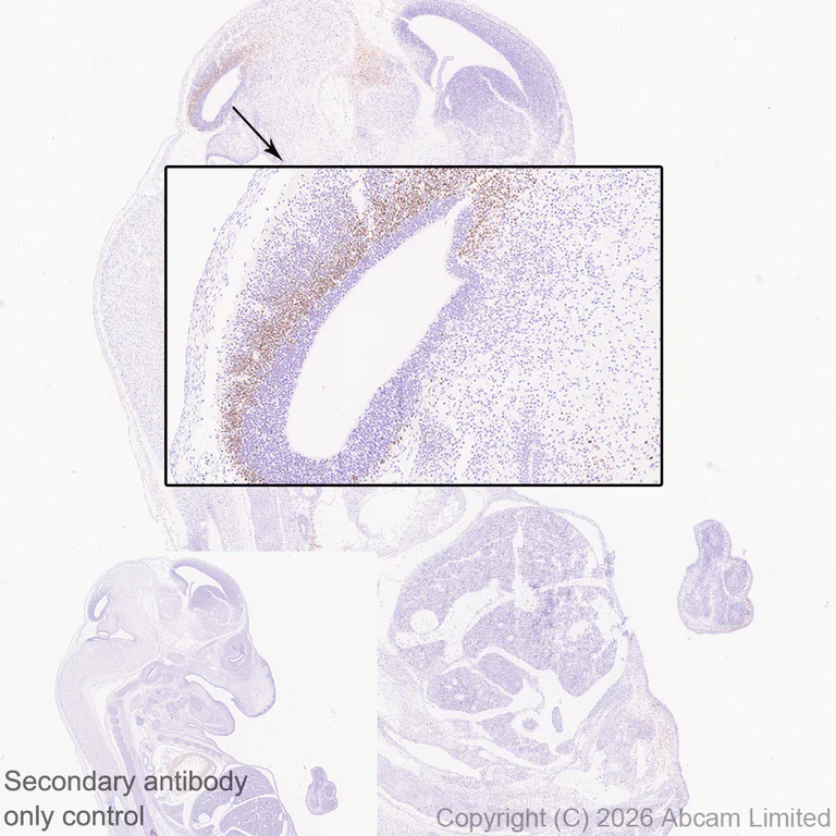 Immunohistochemistry (Formalin/PFA-fixed paraffin-embedded sections) - Anti-SHOX2 antibody [EPR30169-39] (AB326071)