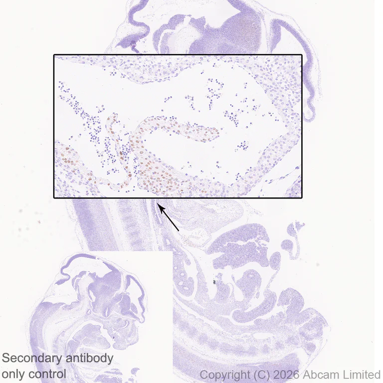 Immunohistochemistry (Formalin/PFA-fixed paraffin-embedded sections) - Anti-SHOX2 antibody [EPR30169-39] (AB326071)