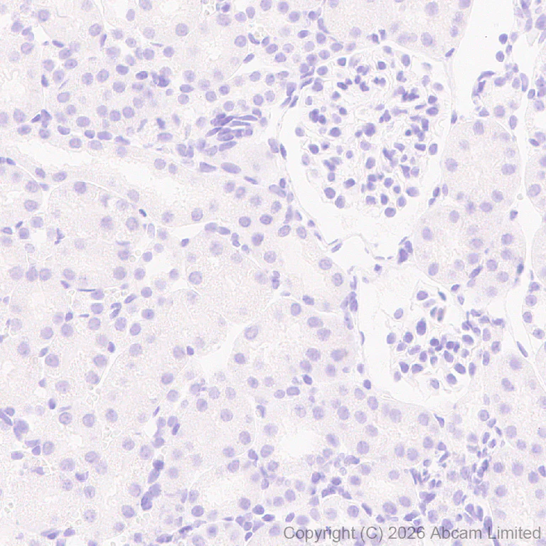 Immunohistochemistry (Formalin/PFA-fixed paraffin-embedded sections) - Anti-SHOX2 antibody [EPR30169-39] (AB326071)