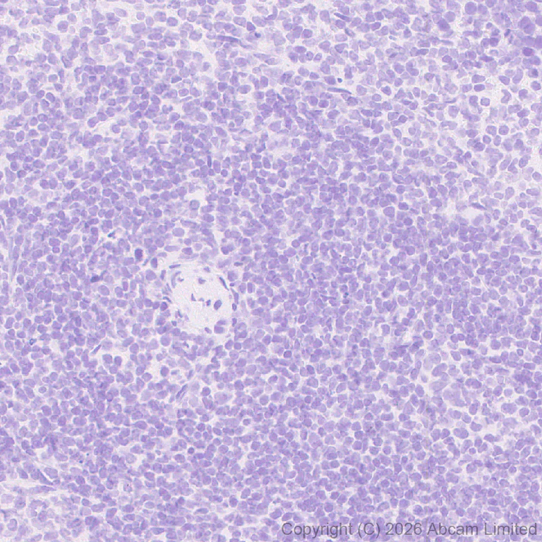 Immunohistochemistry (Formalin/PFA-fixed paraffin-embedded sections) - Anti-SHOX2 antibody [EPR30169-39] (AB326071)