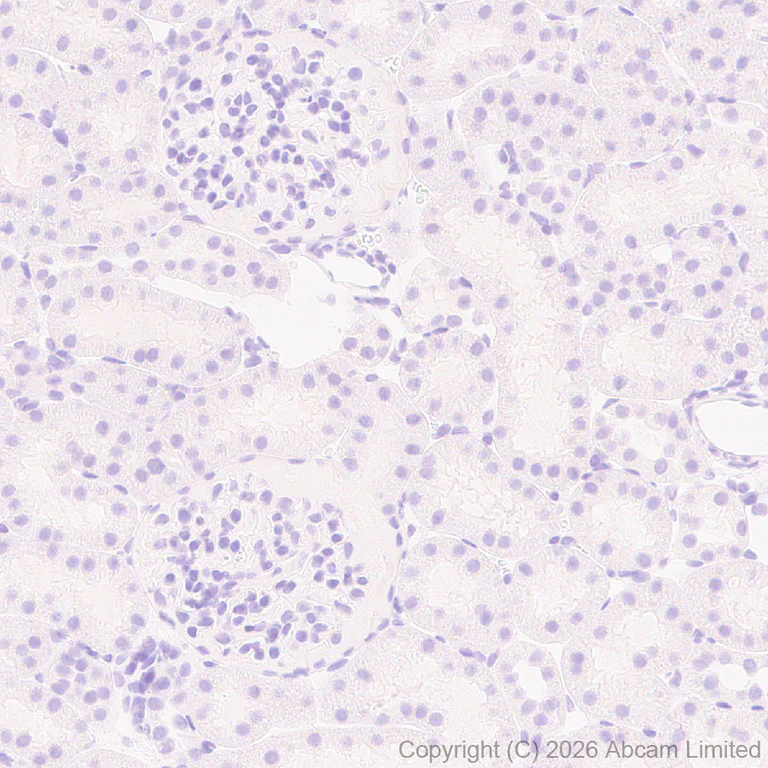Immunohistochemistry (Formalin/PFA-fixed paraffin-embedded sections) - Anti-SHOX2 antibody [EPR30169-39] (AB326071)
