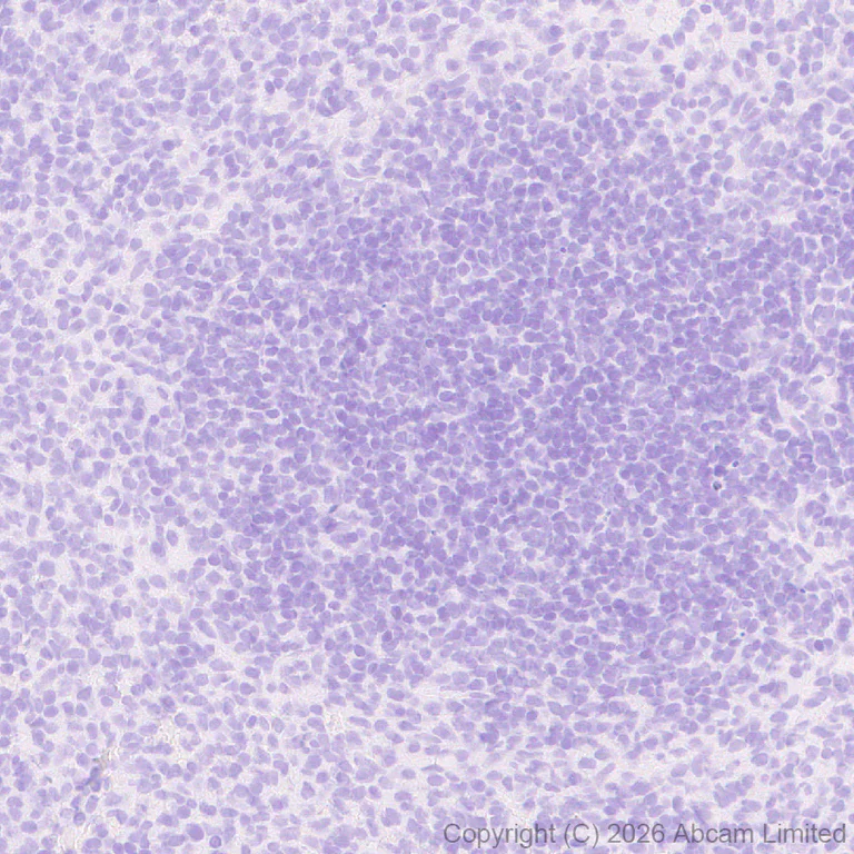 Immunohistochemistry (Formalin/PFA-fixed paraffin-embedded sections) - Anti-SHOX2 antibody [EPR30169-39] (AB326071)